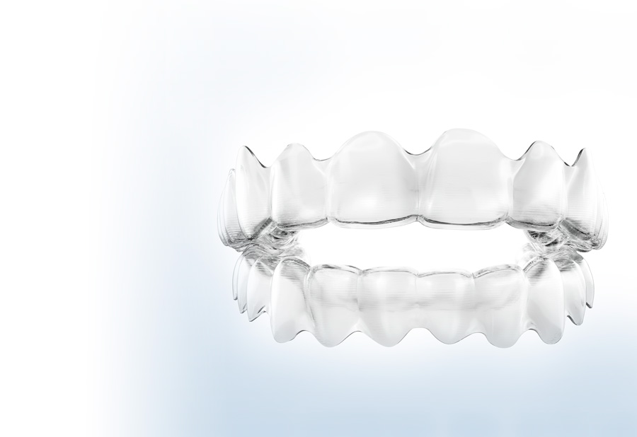 Why are retainers important?